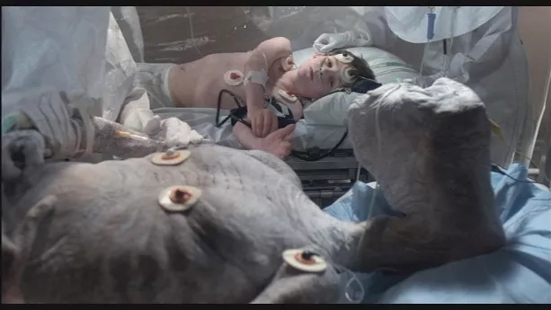 et